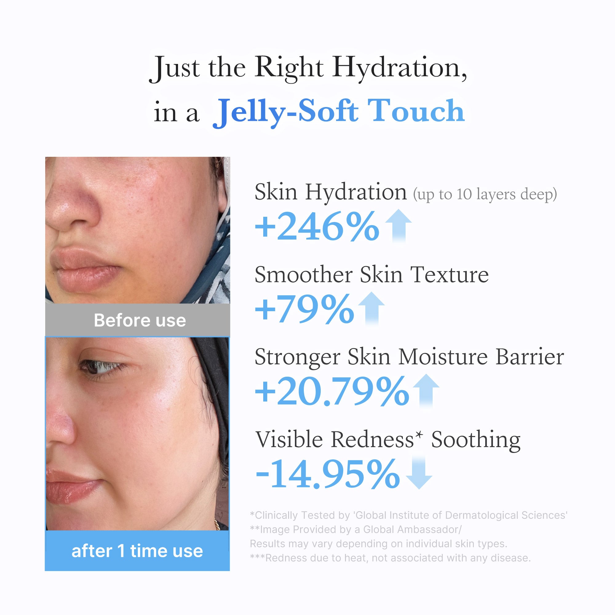 hyaluronic ceramid moisturizing jelly cream