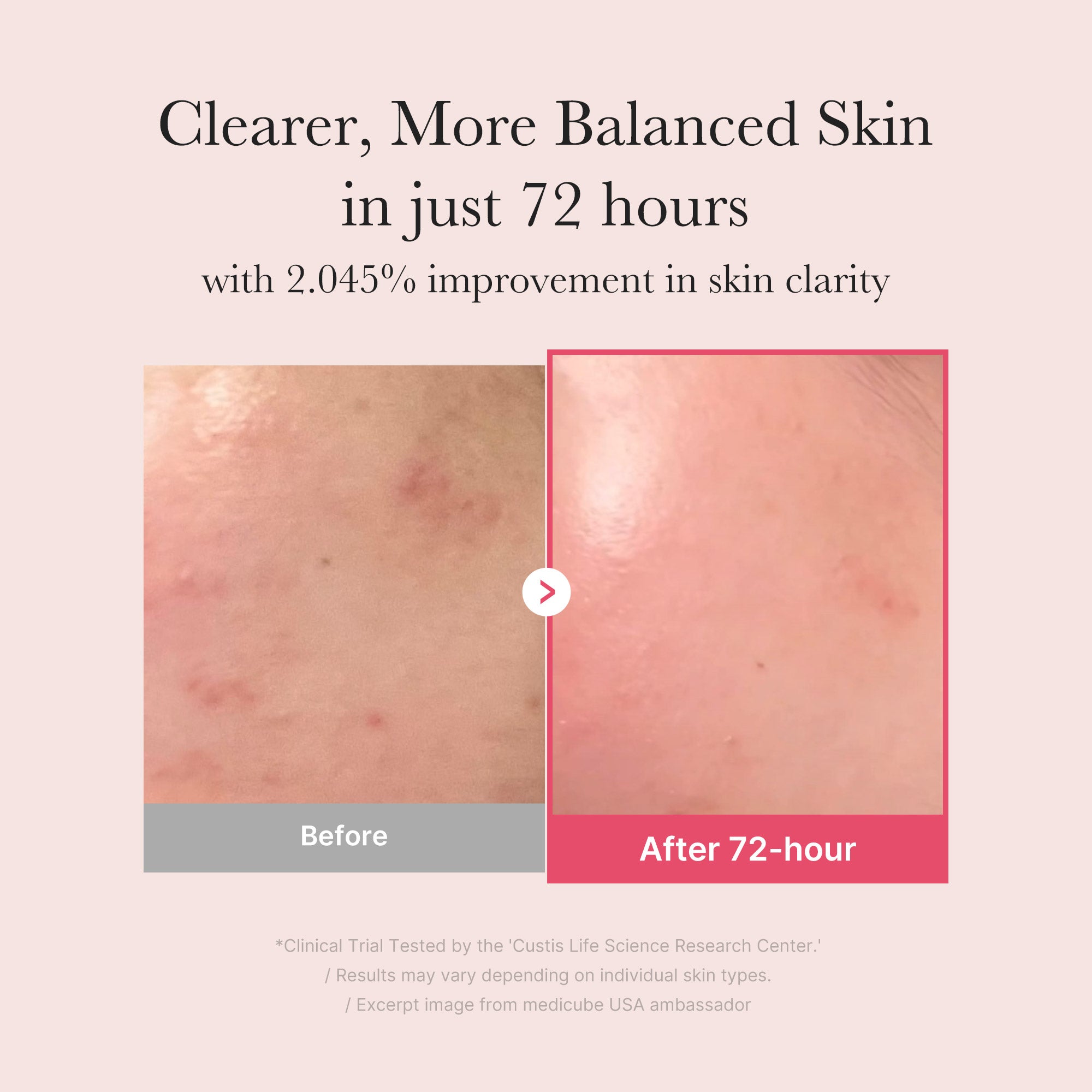 txa niacinamid serum