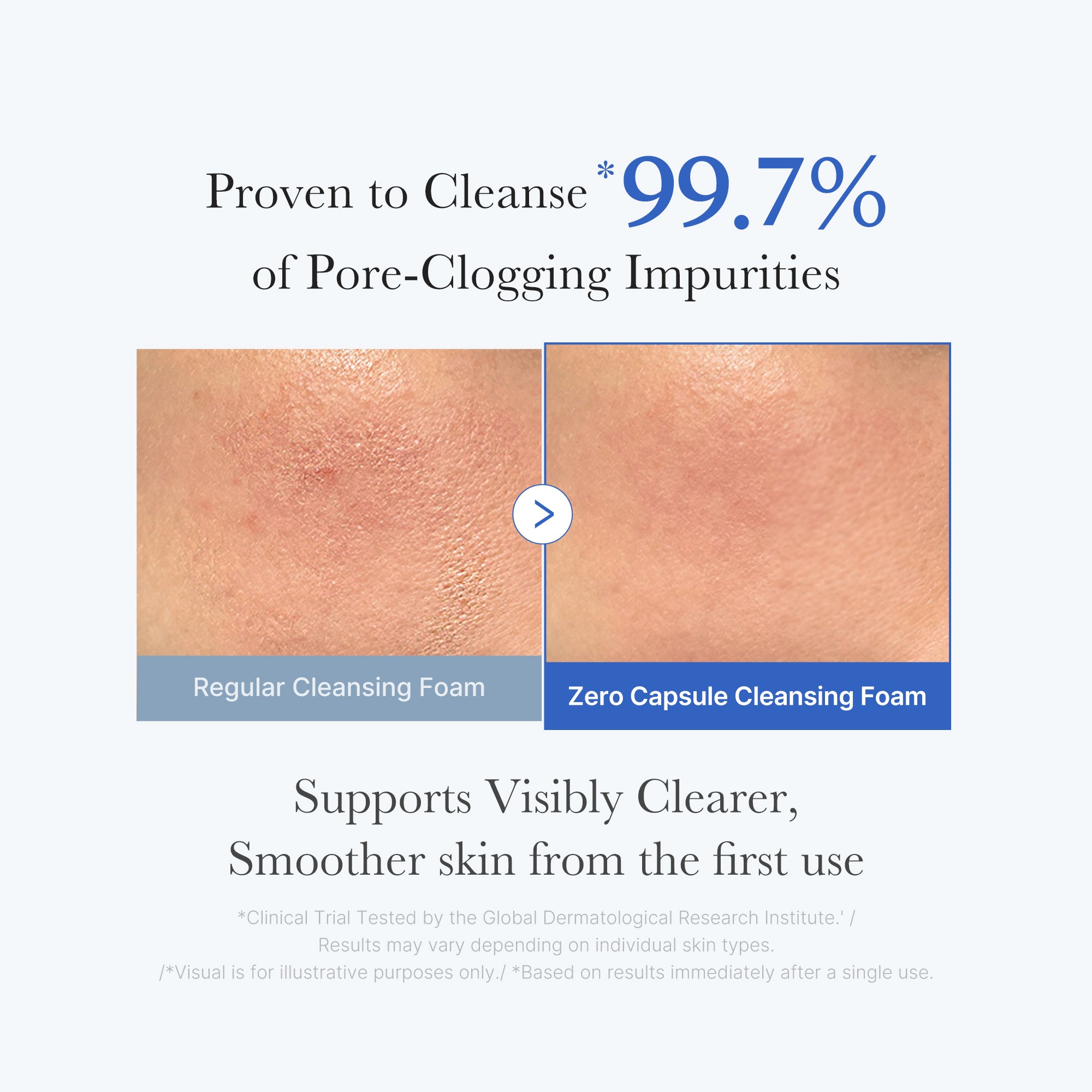 zero pore capsule cleansing foam