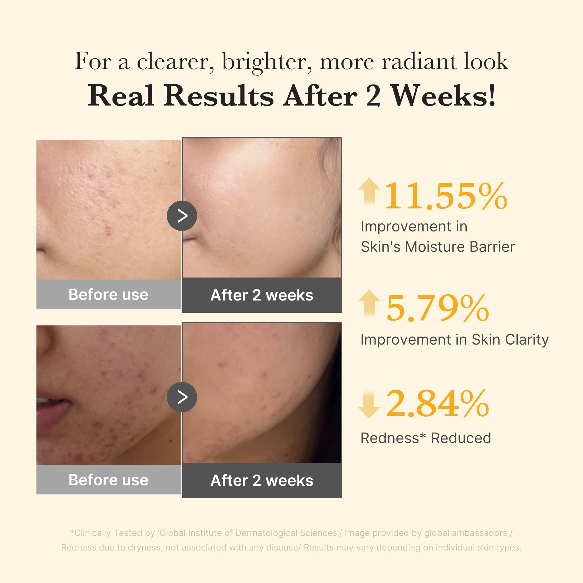 kojic acid gurkmeja kapsel serum