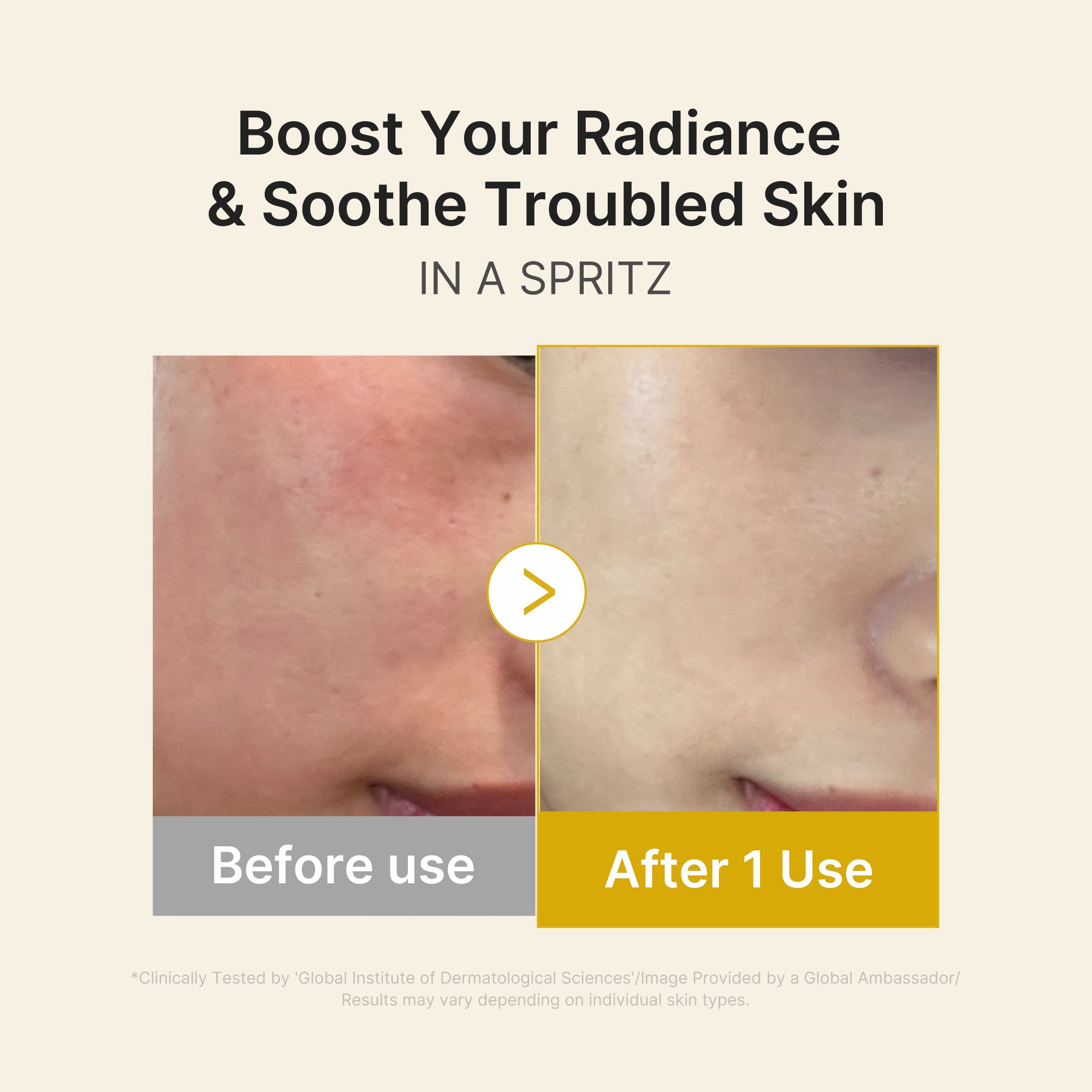 kojic acid gurkmeja vitamin gold jelly mist serum