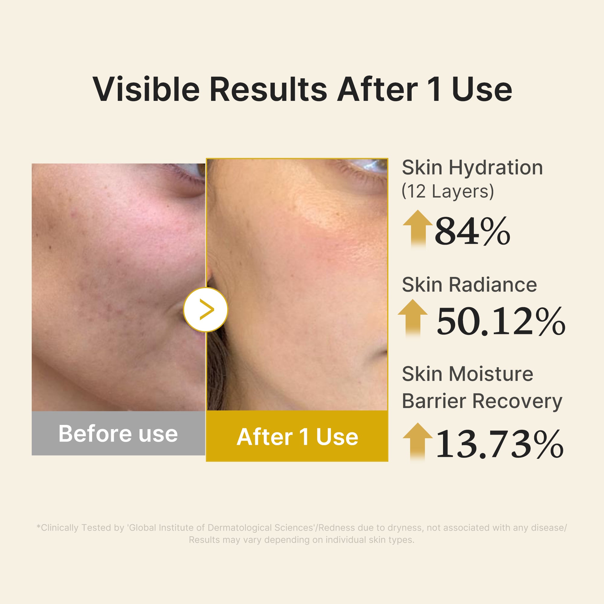 kojic acid gurkmeja vitamin gold jelly mist serum