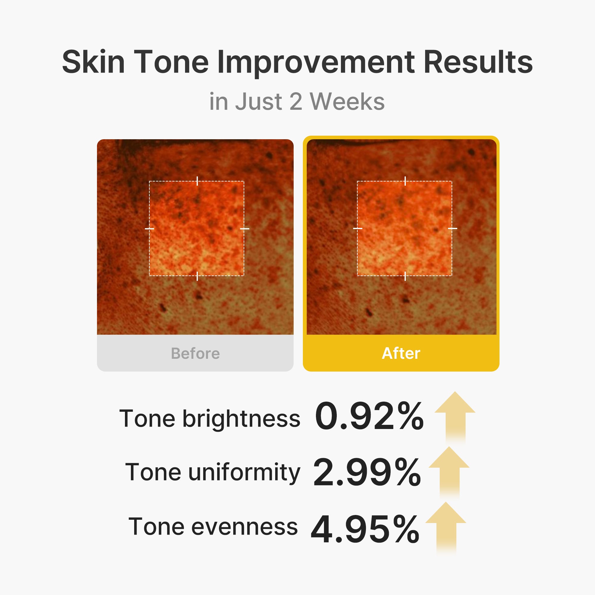 kojic acid gurkmeja vita capsule cream